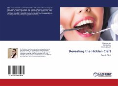 Revealing the Hidden Cleft