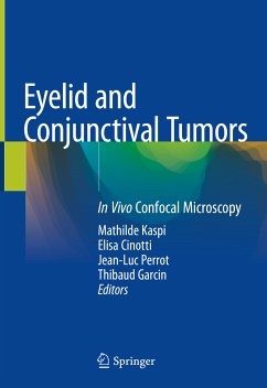 Eyelid and Conjunctival Tumors (eBook, PDF)