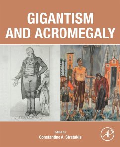 Cover Gigantism and Acromegaly
