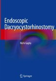 Endoscopic Dacryocystorhinostomy