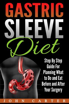 Gastric Sleeve Diet (eBook, ePUB) - Carter, John