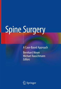 Spine Surgery (eBook, PDF)