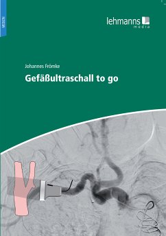 Gefäßultraschall to go (eBook, PDF) - Frömke, Johannes
