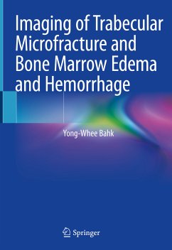 Imaging of Trabecular Microfracture and Bone Marrow Edema and Hemorrhage (eBook, PDF) - Bahk, Yong-Whee