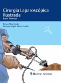 Cirurgia Laparoscópica Ilustrada (eBook, ePUB)