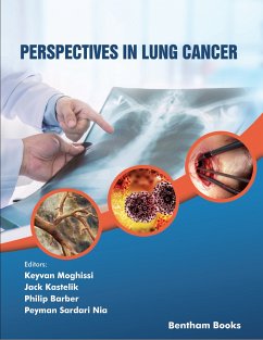 Perspectives in Lung Cancer (eBook, ePUB)