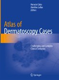 Atlas of Dermatoscopy Cases (eBook, PDF)