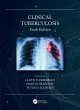 Clinical Tuberculosis (eBook, PDF) - Bild 1
