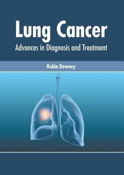Lung Cancer: Advances in Diagnosis and Treatment
