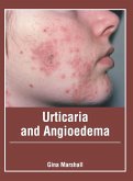 Urticaria and Angioedema