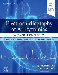 Electrocardiography of Arrhythmias: A Comprehensive Review - Das, Mithilesh Kumar; Zipes, Douglas P