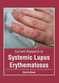 Current Research in Systemic Lupus Erythematosus