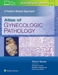 Atlas of Gynecologic Pathology - Numan, Tricia A., MD
