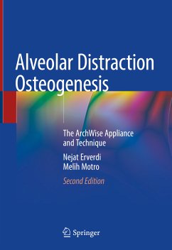 Alveolar Distraction Osteogenesis (eBook, PDF) - Erverdi, Nejat; Motro, Melih