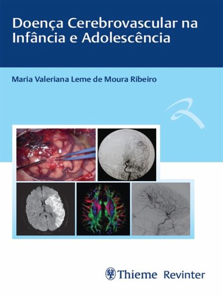 Doença Cerebrovascular na Infância e Adolescência (eBook, ePUB)