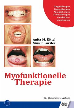Myofunktionelle Therapie - Kittel, Anita;Förster, Nina T.