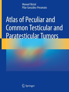 Atlas of Peculiar and Common Testicular and Paratesticular Tumors - Nistal, Manuel;González-Peramato, Pilar
