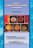 The Atlas of Retinal Diseases in Nigerians The Atlas of Retinal Diseases in Nigerians