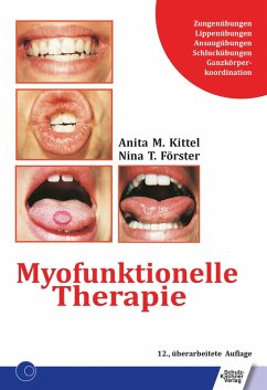 Myofunktionelle Therapie (eBook, PDF) - Förster, Nina T.; Kittel, Anita