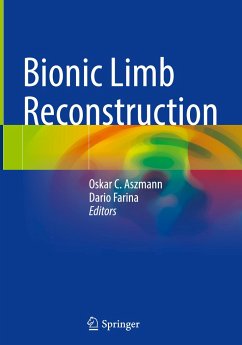 Bionic Limb Reconstruction