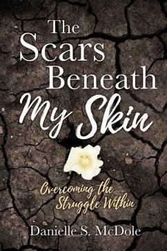 The Scars Beneath My Skin: Overcoming the Struggle Within - McDole, Danielle S.