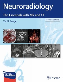 Neuroradiology (eBook, PDF) - Runge, Val M.