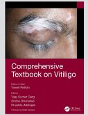 Comprehensive Textbook on Vitiligo (eBook, PDF)