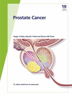 Fast Facts: Prostate Cancer (eBook, ePUB) - Kirby, R. S.; Patel, M. I.; Poon, D. M. C.