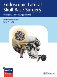 Cover Endoscopic Lateral Skull Base Surgery