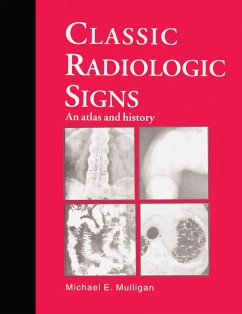 Classic Radiologic Signs (eBook, PDF) - Mulligan, M. E.