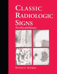 Classic Radiologic Signs (eBook, ePUB) - Mulligan, M. E.