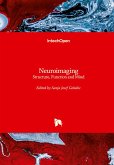 Neuroimaging