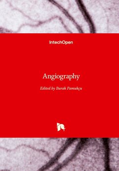 Angiography