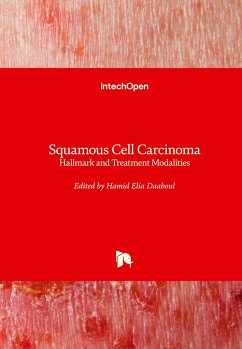 Squamous Cell Carcinoma