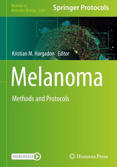 Melanoma