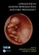 Ultrasound in Assisted Reproduction and... - Bild 1