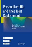 Personalized Hip and Knee Joint Replacement