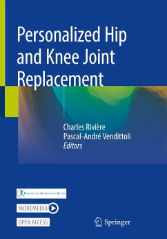 Personalized Hip and Knee Joint Replacement