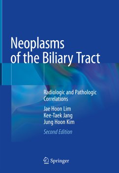 Neoplasms of the Biliary Tract (eBook, PDF) - Lim, Jae Hoon; Jang, Kee-Taek; Kim, Jung Hoon