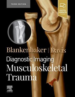 Diagnostic Imaging: Musculoskeletal Trauma - Blankenbaker, Donna G; Davis, Kirkland W