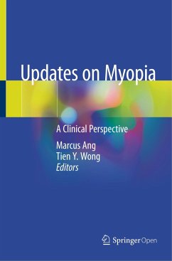 Updates on Myopia