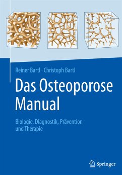 Das Osteoporose Manual - Bartl, Reiner;Bartl, Christoph