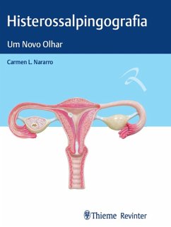 Histerossalpingografia (eBook, ePUB) - Navarro, Carmen L.