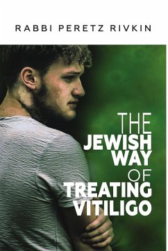 The Jewish Way of Treating Vitiligo - Rivkin, Rabbi Peretz