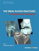 The Tibial Plateau Fractures: Diagnosis and Treatment (eBook, ePUB)