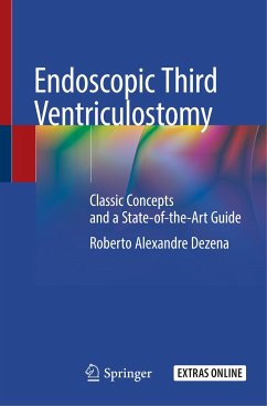 Endoscopic Third Ventriculostomy - Dezena, Roberto Alexandre