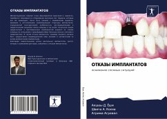 OTKAZY IMPLANTATOV - Joshi, Akshay D.;Kolhe, Shweta A.;Agrawal, Agrima