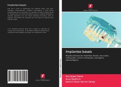 Implantes basais - Desai, Harshjeet;Dadhich, Anuj;Harish Saluja, Seemit Shah