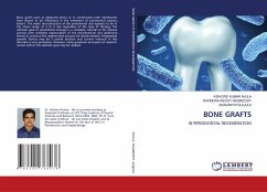 BONE GRAFTS - AVULA, KISHORE KUMAR;NAGIREDDY, RAVINDRA REDDY;GUJJULA, SRAVANTHI