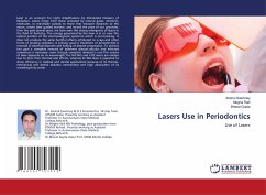 Lasers Use in Periodontics - Sawhney, Anshul;Ralli, Megha;Gupta, Bharat